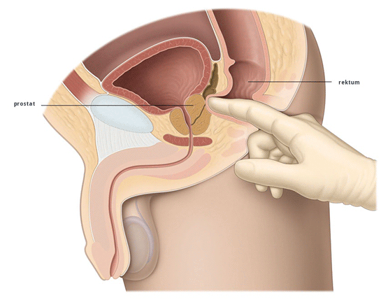 Prostat Boyutlar
