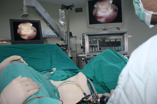 Prostat Ameliyatı